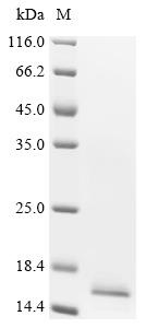 Recombinant Human Bromodomain-containing protein 2 (BRD2) , partial - image 1
