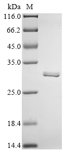 Recombinant Rat Carbonic anhydrase 2 (Ca2) - image 1