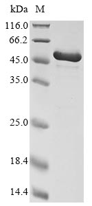 (Tris-Glycine gel) Discontinuous SDS-PAGE (reduced) with 5% enrichment gel and 15% separation gel. (Tris-Glycine gel) Discontinuous SDS-PAGE (reduced) with 5% enrichment gel and 15% separation gel.