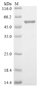Recombinant Human Calreticulin (CALR) - image 1
