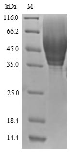 (Tris-Glycine gel) Discontinuous SDS-PAGE (reduced) with 5% enrichment gel and 15% separation gel. (Tris-Glycine gel) Discontinuous SDS-PAGE (reduced) with 5% enrichment gel and 15% separation gel.