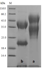 (Tris-Glycine gel) Discontinuous SDS-PAGE (reduced) with 5% enrichment gel and 15% separation gel.