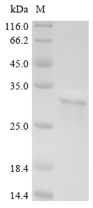 (Tris-Glycine gel) Discontinuous SDS-PAGE (reduced) with 5% enrichment gel and 15% separation gel. (Tris-Glycine gel) Discontinuous SDS-PAGE (reduced) with 5% enrichment gel and 15% separation gel.