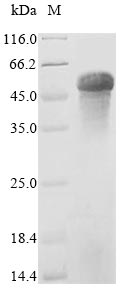 (Tris-Glycine gel) Discontinuous SDS-PAGE (reduced) with 5% enrichment gel and 15% separation gel. (Tris-Glycine gel) Discontinuous SDS-PAGE (reduced) with 5% enrichment gel and 15% separation gel.