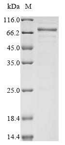 (Tris-Glycine gel) Discontinuous SDS-PAGE (reduced) with 5% enrichment gel and 15% separation gel. (Tris-Glycine gel) Discontinuous SDS-PAGE (reduced) with 5% enrichment gel and 15% separation gel.