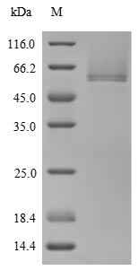 (Tris-Glycine gel) Discontinuous SDS-PAGE (reduced) with 5% enrichment gel and 15% separation gel. (Tris-Glycine gel) Discontinuous SDS-PAGE (reduced) with 5% enrichment gel and 15% separation gel.