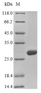 (Tris-Glycine gel) Discontinuous SDS-PAGE (reduced) with 5% enrichment gel and 15% separation gel. (Tris-Glycine gel) Discontinuous SDS-PAGE (reduced) with 5% enrichment gel and 15% separation gel.