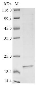 (Tris-Glycine gel) Discontinuous SDS-PAGE (reduced) with 5% enrichment gel and 15% separation gel. (Tris-Glycine gel) Discontinuous SDS-PAGE (reduced) with 5% enrichment gel and 15% separation gel.