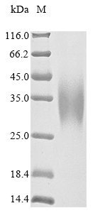 Recombinant Human Carbamoyl-phosphate synthase [ammonia], mitochondrial (CPS1) , partial - image 1