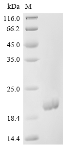 Recombinant Mouse Granulocyte-macrophage colony-stimulating factor (Csf2) - image 1