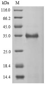 (Tris-Glycine gel) Discontinuous SDS-PAGE (reduced) with 5% enrichment gel and 15% separation gel. (Tris-Glycine gel) Discontinuous SDS-PAGE (reduced) with 5% enrichment gel and 15% separation gel.