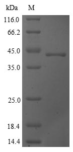 (Tris-Glycine gel) Discontinuous SDS-PAGE (reduced) with 5% enrichment gel and 15% separation gel. (Tris-Glycine gel) Discontinuous SDS-PAGE (reduced) with 5% enrichment gel and 15% separation gel.