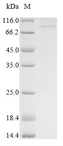 (Tris-Glycine gel) Discontinuous SDS-PAGE (reduced) with 5% enrichment gel and 15% separation gel. (Tris-Glycine gel) Discontinuous SDS-PAGE (reduced) with 5% enrichment gel and 15% separation gel.