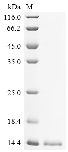 Recombinant Mouse Acyl-CoA-binding protein (Dbi) - image 1
