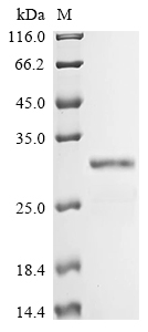 Recombinant Human Deoxycytidine kinase (DCK) - image 1