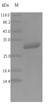 (Tris-Glycine gel) Discontinuous SDS-PAGE (reduced) with 5% enrichment gel and 15% separation gel. (Tris-Glycine gel) Discontinuous SDS-PAGE (reduced) with 5% enrichment gel and 15% separation gel.