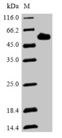 (Tris-Glycine gel) Discontinuous SDS-PAGE (reduced) with 5% enrichment gel and 15% separation gel. (Tris-Glycine gel) Discontinuous SDS-PAGE (reduced) with 5% enrichment gel and 15% separation gel.