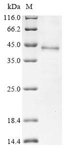 Recombinant Human Dipeptidase 1 (DPEP1) - image 1