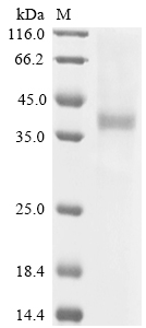 Recombinant Sheep Dipeptidase 1 (DPEP1) - image 1
