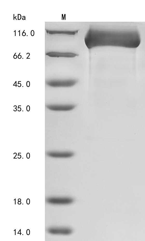 Recombinant Human Dipeptidyl peptidase 4 (DPP4) , partial - image 1