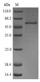 (Tris-Glycine gel) Discontinuous SDS-PAGE (reduced) with 5% enrichment gel and 15% separation gel. (Tris-Glycine gel) Discontinuous SDS-PAGE (reduced) with 5% enrichment gel and 15% separation gel.