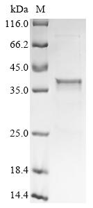 Recombinant Mouse Ectonucleotide pyrophosphatase/phosphodiesterase family member 1 (Enpp1) , partial - image 1