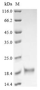 (Tris-Glycine gel) Discontinuous SDS-PAGE (reduced) with 5% enrichment gel and 15% separation gel. (Tris-Glycine gel) Discontinuous SDS-PAGE (reduced) with 5% enrichment gel and 15% separation gel.
