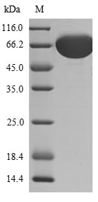 (Tris-Glycine gel) Discontinuous SDS-PAGE (reduced) with 5% enrichment gel and 15% separation gel. (Tris-Glycine gel) Discontinuous SDS-PAGE (reduced) with 5% enrichment gel and 15% separation gel.