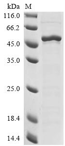(Tris-Glycine gel) Discontinuous SDS-PAGE (reduced) with 5% enrichment gel and 15% separation gel. (Tris-Glycine gel) Discontinuous SDS-PAGE (reduced) with 5% enrichment gel and 15% separation gel.
