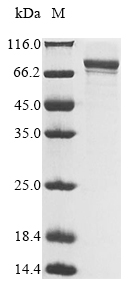 (Tris-Glycine gel) Discontinuous SDS-PAGE (reduced) with 5% enrichment gel and 15% separation gel. (Tris-Glycine gel) Discontinuous SDS-PAGE (reduced) with 5% enrichment gel and 15% separation gel.