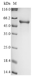 Recombinant Human Formimidoyltransferase-cyclodeaminase (FTCD) - image 1