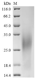 (Tris-Glycine gel) Discontinuous SDS-PAGE (reduced) with 5% enrichment gel and 15% separation gel. (Tris-Glycine gel) Discontinuous SDS-PAGE (reduced) with 5% enrichment gel and 15% separation gel.