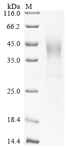 (Tris-Glycine gel) Discontinuous SDS-PAGE (reduced) with 5% enrichment gel and 15% separation gel. (Tris-Glycine gel) Discontinuous SDS-PAGE (reduced) with 5% enrichment gel and 15% separation gel.