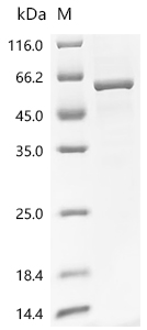 Recombinant Human Glucose-6-phosphate 1-dehydrogenase (G6PD) - image 1