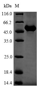 (Tris-Glycine gel) Discontinuous SDS-PAGE (reduced) with 5% enrichment gel and 15% separation gel. (Tris-Glycine gel) Discontinuous SDS-PAGE (reduced) with 5% enrichment gel and 15% separation gel.