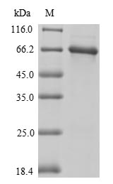 (Tris-Glycine gel) Discontinuous SDS-PAGE (reduced) with 5% enrichment gel and 15% separation gel. (Tris-Glycine gel) Discontinuous SDS-PAGE (reduced) with 5% enrichment gel and 15% separation gel.