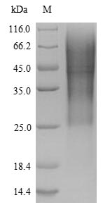 SDS-PAGE- Recombinant protein Rat Glp1r