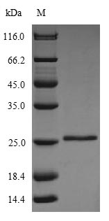 (Tris-Glycine gel) Discontinuous SDS-PAGE (reduced) with 5% enrichment gel and 15% separation gel. (Tris-Glycine gel) Discontinuous SDS-PAGE (reduced) with 5% enrichment gel and 15% separation gel.