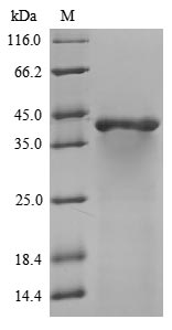 (Tris-Glycine gel) Discontinuous SDS-PAGE (reduced) with 5% enrichment gel and 15% separation gel. (Tris-Glycine gel) Discontinuous SDS-PAGE (reduced) with 5% enrichment gel and 15% separation gel.