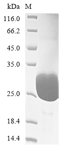 (Tris-Glycine gel) Discontinuous SDS-PAGE (reduced) with 5% enrichment gel and 15% separation gel. (Tris-Glycine gel) Discontinuous SDS-PAGE (reduced) with 5% enrichment gel and 15% separation gel.