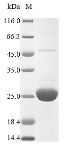 (Tris-Glycine gel) Discontinuous SDS-PAGE (reduced) with 5% enrichment gel and 15% separation gel. (Tris-Glycine gel) Discontinuous SDS-PAGE (reduced) with 5% enrichment gel and 15% separation gel.