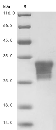 (Tris-Glycine gel) Discontinuous SDS-PAGE (reduced) with 5% enrichment gel and 15% separation gel. (Tris-Glycine gel) Discontinuous SDS-PAGE (reduced) with 5% enrichment gel and 15% separation gel.