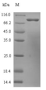 (Tris-Glycine gel) Discontinuous SDS-PAGE (reduced) with 5% enrichment gel and 15% separation gel. (Tris-Glycine gel) Discontinuous SDS-PAGE (reduced) with 5% enrichment gel and 15% separation gel.