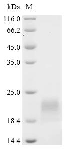 Recombinant Human Vigilin (HDLBP) , partial - image 1