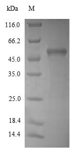 (Tris-Glycine gel) Discontinuous SDS-PAGE (reduced) with 5% enrichment gel and 15% separation gel. (Tris-Glycine gel) Discontinuous SDS-PAGE (reduced) with 5% enrichment gel and 15% separation gel.
