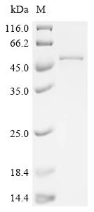 Recombinant Mouse Hydroxymethylglutaryl-CoA synthase, mitochondrial (Hmgcs2) - image 1