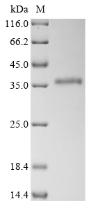 Recombinant Human Heterogeneous nuclear ribonucleoproteins A2/B1 (HNRNPA2B1) - image 1