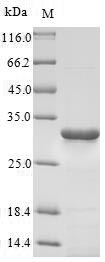 (Tris-Glycine gel) Discontinuous SDS-PAGE (reduced) with 5% enrichment gel and 15% separation gel. (Tris-Glycine gel) Discontinuous SDS-PAGE (reduced) with 5% enrichment gel and 15% separation gel.