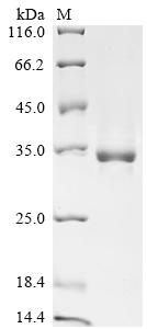 (Tris-Glycine gel) Discontinuous SDS-PAGE (reduced) with 5% enrichment gel and 15% separation gel. (Tris-Glycine gel) Discontinuous SDS-PAGE (reduced) with 5% enrichment gel and 15% separation gel.