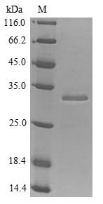 (Tris-Glycine gel) Discontinuous SDS-PAGE (reduced) with 5% enrichment gel and 15% separation gel. (Tris-Glycine gel) Discontinuous SDS-PAGE (reduced) with 5% enrichment gel and 15% separation gel.